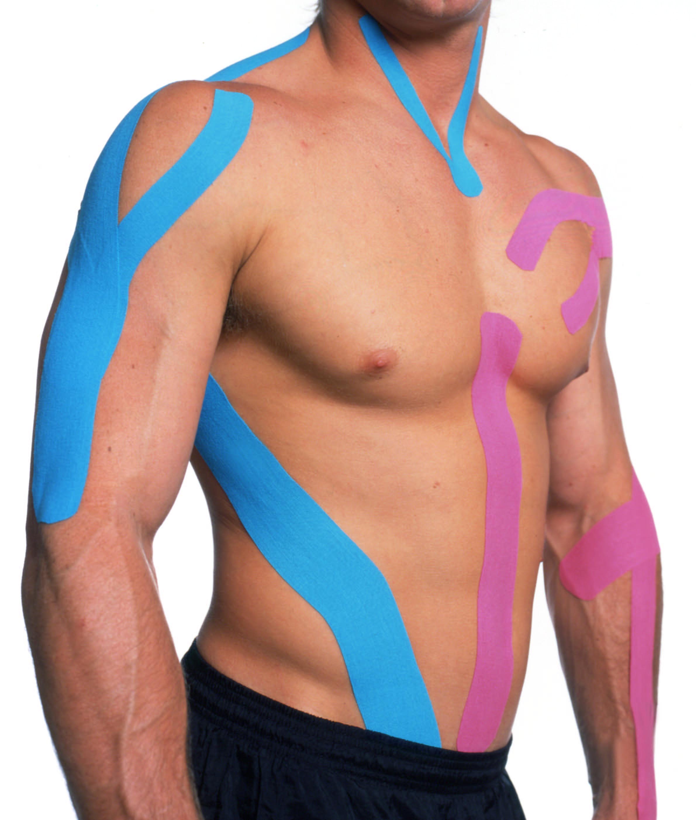 Kinesio Tape