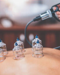 Cupping Therapy Mobilization (body correction)